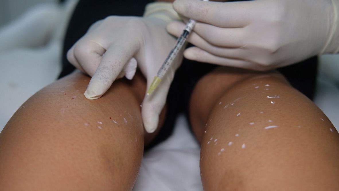 Practical Botox injection demonstration