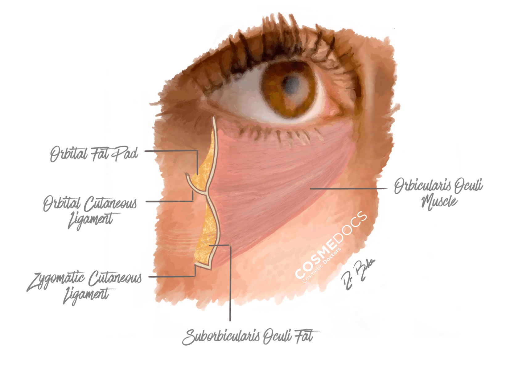 Tear Trough Anatomy by Dr Ahmed Haq - Advanced Aesthetic Medicine Dr Ahmed Haq tear trough anatomy diagram - orbital fat pad, ligaments, facial anatomy for aesthetic medicine training