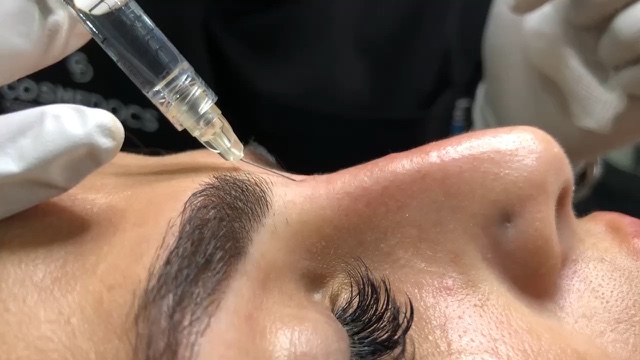 Advanced Botox & Dermal Fillers course training